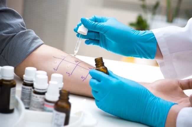 Skin prick test