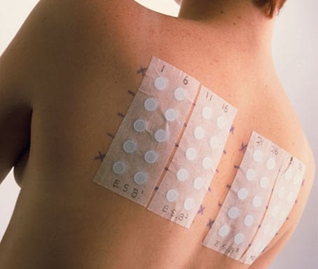 Patch Test